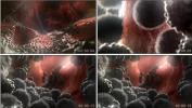 三维人体癌症细胞被消灭痊愈 医疗细菌模型3D视频展示视频